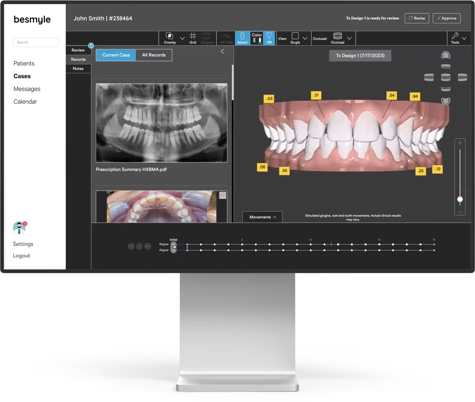 Monitor showing the besmyle portal software