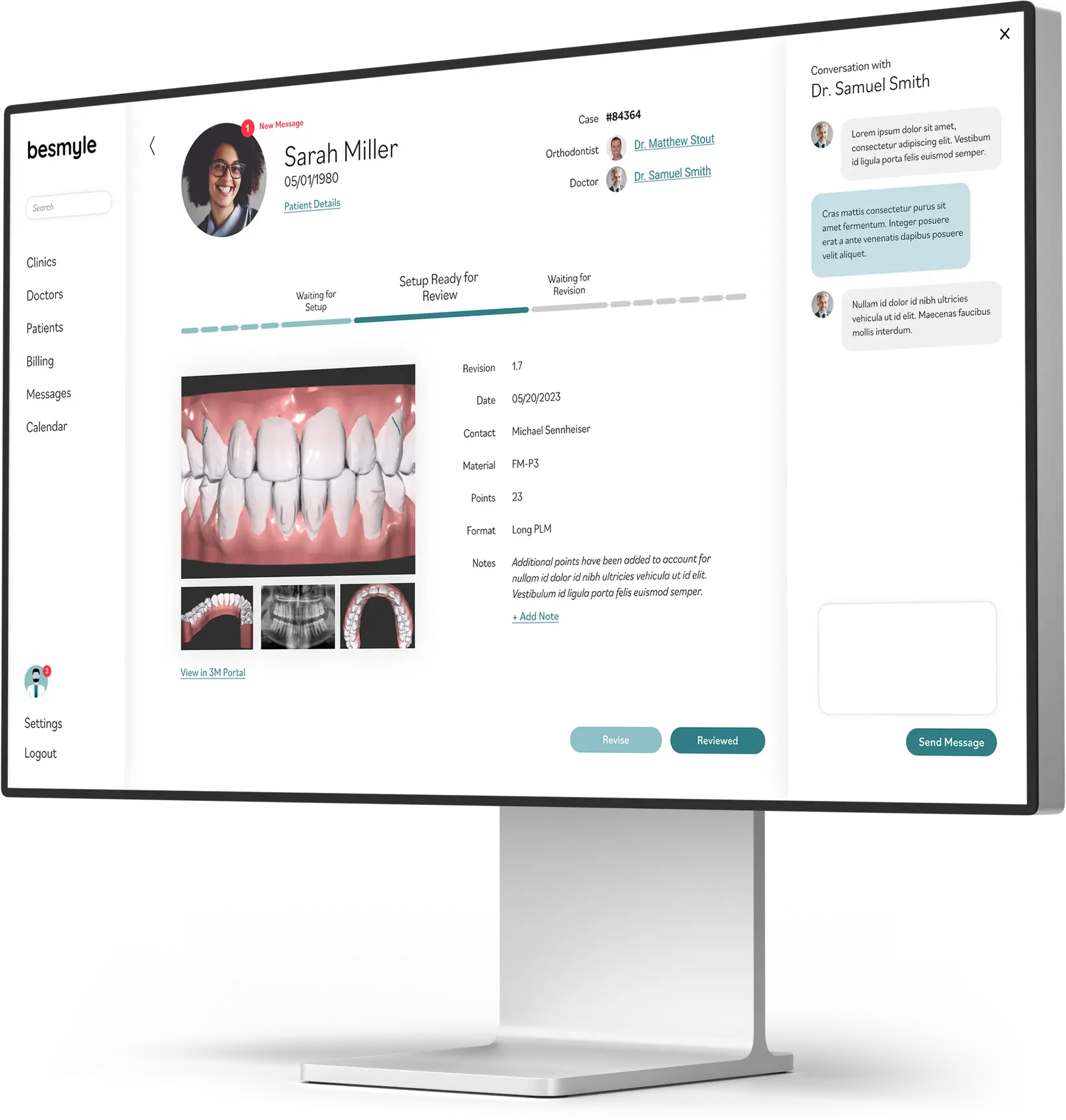 Monitor with the besmyle software portal